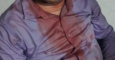 नाशिक महापालिकेच्या हलगर्जीपणाचा कळस; कपालेश्वर मंदिर परिसरात भिंत कोसळून भाविक जखमी      महापालिकेच्या निष्क्रिय कारभारामुळे भाविकांच्या जीवाशी खेळ; कुंभमेळ्यापूर्वीच धोक्याची घंटा