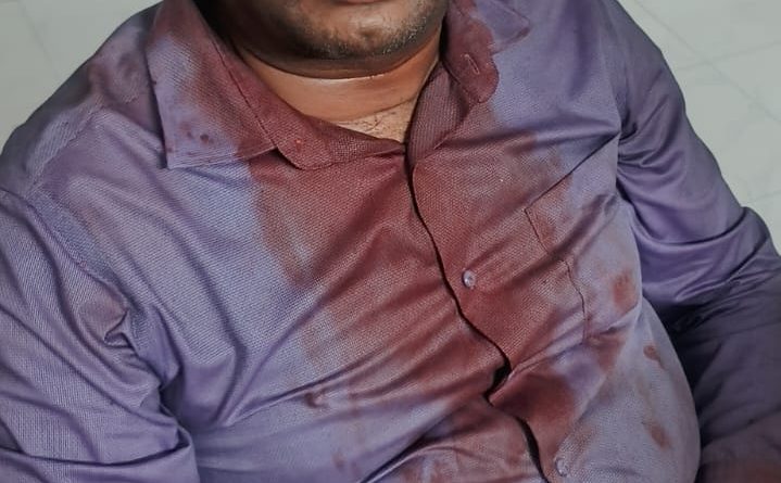 नाशिक महापालिकेच्या हलगर्जीपणाचा कळस; कपालेश्वर मंदिर परिसरात भिंत कोसळून भाविक जखमी महापालिकेच्या निष्क्रिय कारभारामुळे भाविकांच्या जीवाशी खेळ; कुंभमेळ्यापूर्वीच धोक्याची घंटा नाशिक महापालिकेच्या हलगर्जीपणाचा कळस; कपालेश्वर मंदिर परिसरात भिंत कोसळून भाविक जखमी महापालिकेच्या निष्क्रिय कारभारामुळे भाविकांच्या जीवाशी खेळ; कुंभमेळ्यापूर्वीच धोक्याची घंटा